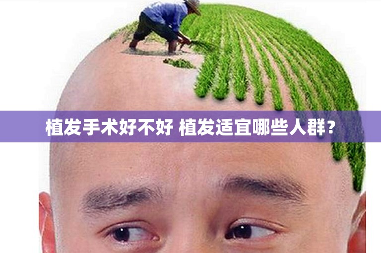 植发手术好不好 植发适宜哪些人群？