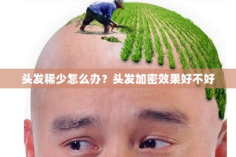 头发稀少怎么办？头发加密效果好不好