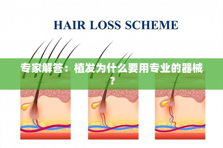 专家解答：植发为什么要用专业的器械？