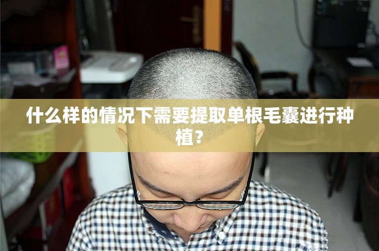 什么样的情况下需要提取单根毛囊进行种植？