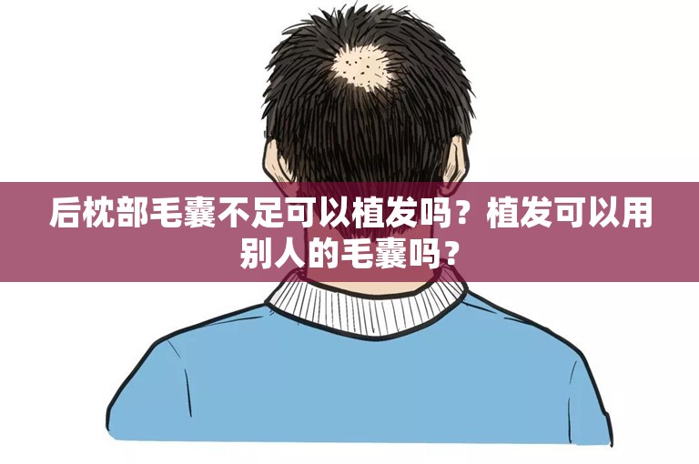 后枕部毛囊不足可以植发吗？植发可以用别人的毛囊吗？