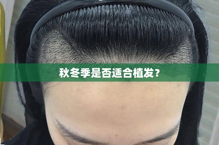 秋冬季是否适合植发？