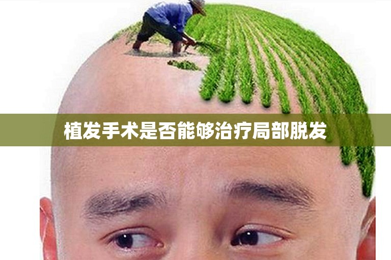 植发手术是否能够治疗局部脱发