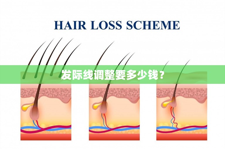 发际线调整要多少钱？