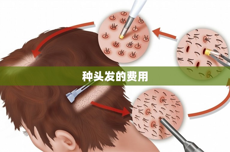 种头发的费用