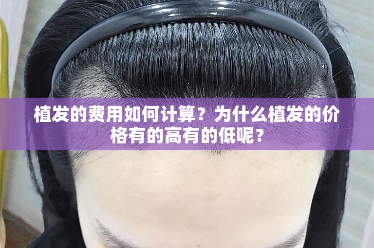 植发的费用如何计算？为什么植发的价格有的高有的低呢？