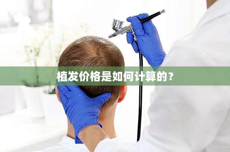 植发价格是如何计算的？