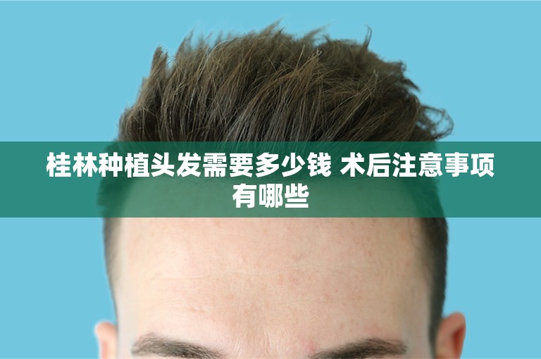 桂林种植头发需要多少钱 术后注意事项有哪些