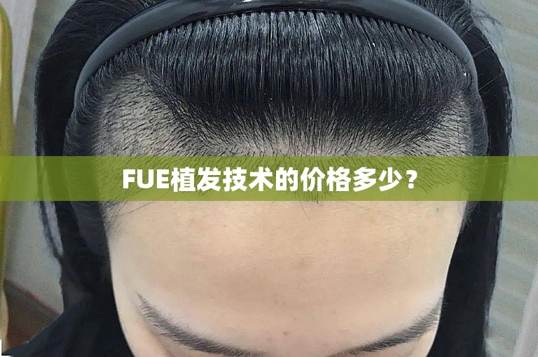 FUE植发技术的价格多少？