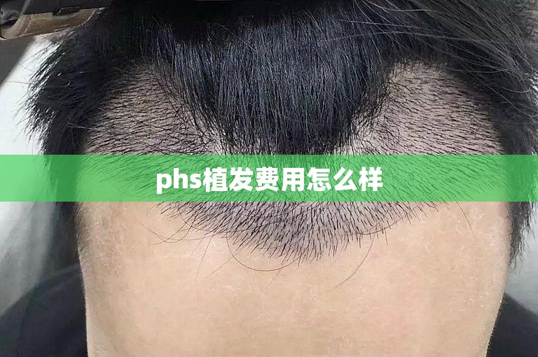 phs植发费用怎么样