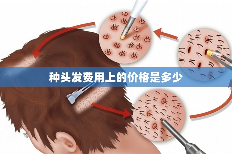 种头发费用上的价格是多少