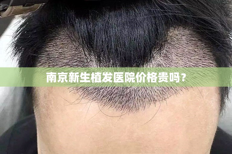 南京新生植发医院价格贵吗？