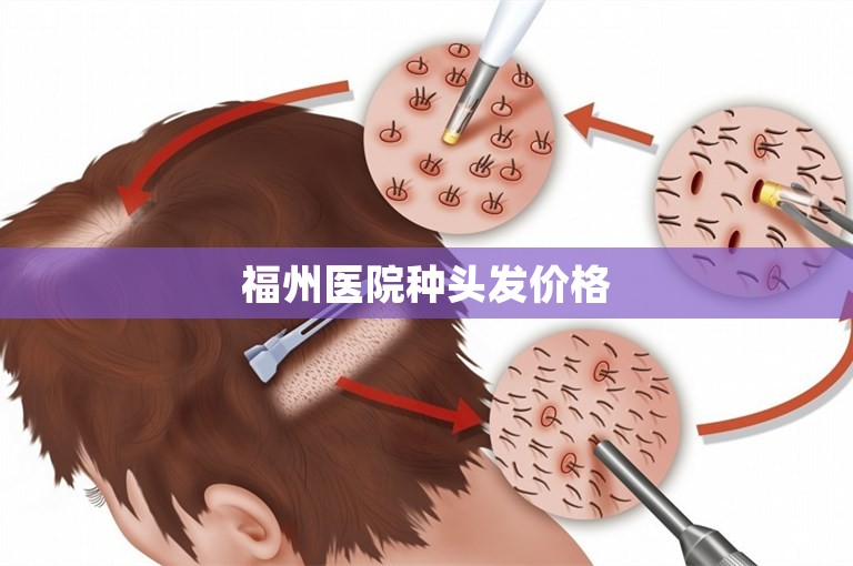 福州医院种头发价格