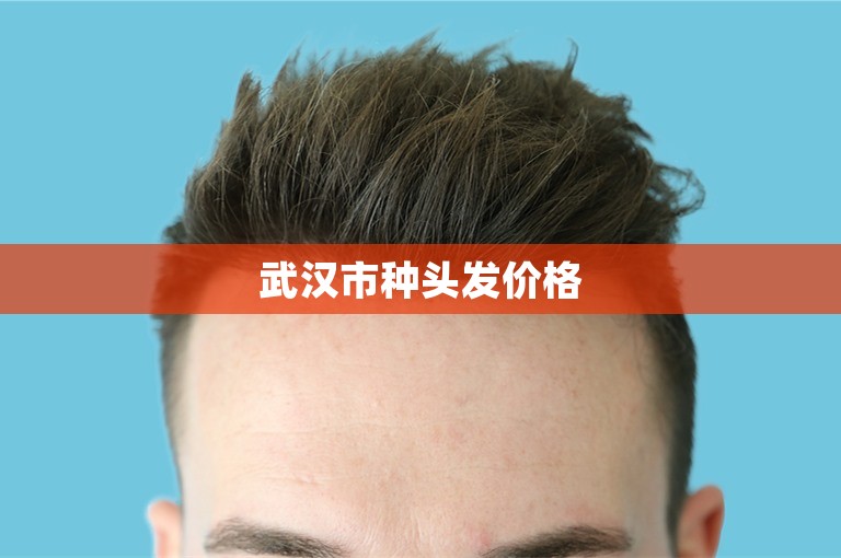 武汉市种头发价格