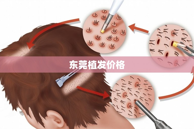 东莞植发价格