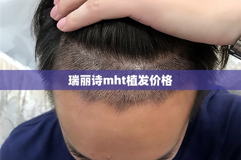 瑞丽诗mht植发价格