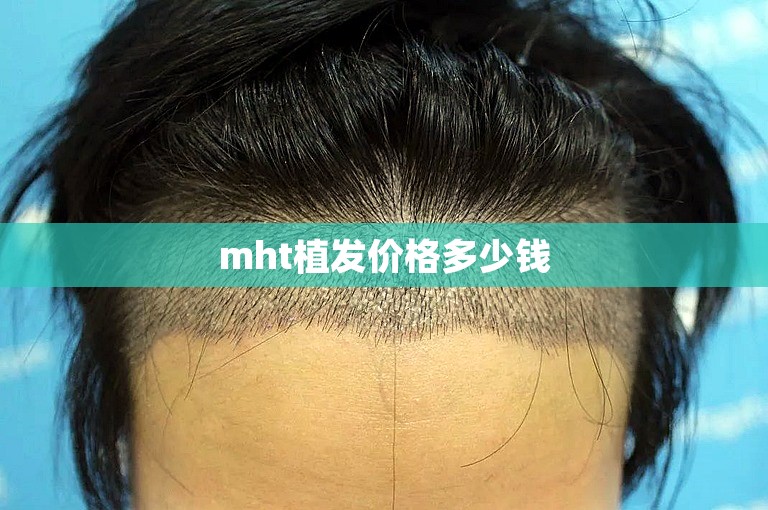 mht植发价格多少钱