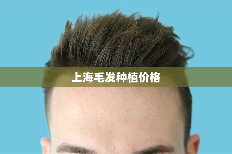 上海毛发种植价格
