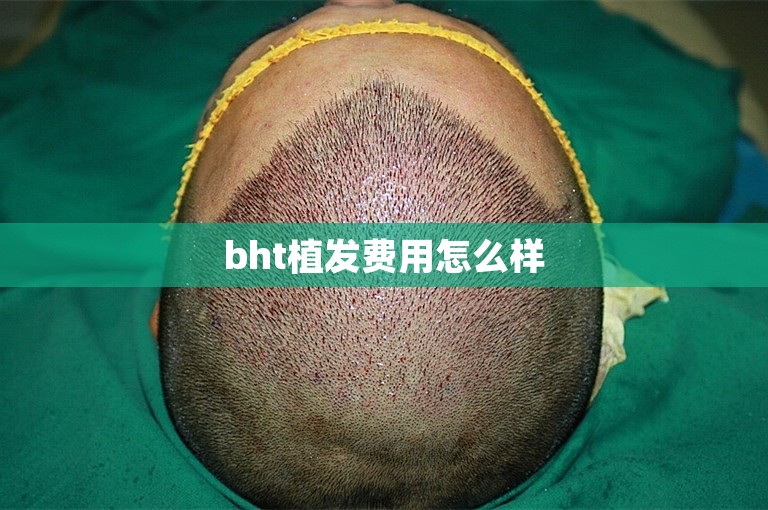 bht植发费用怎么样