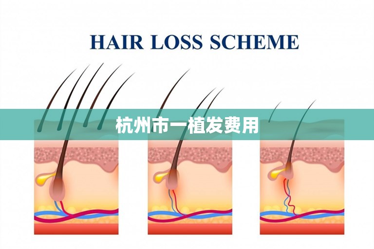 杭州市一植发费用
