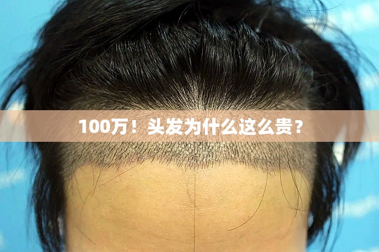 100万！头发为什么这么贵？