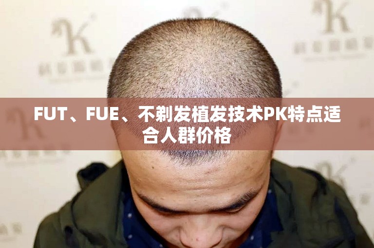 FUT、FUE、不剃发植发技术PK特点适合人群价格