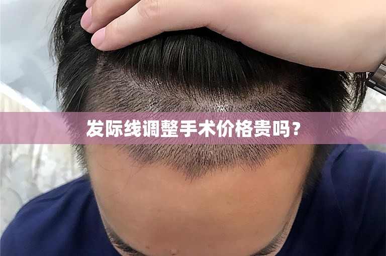 发际线调整手术价格贵吗？