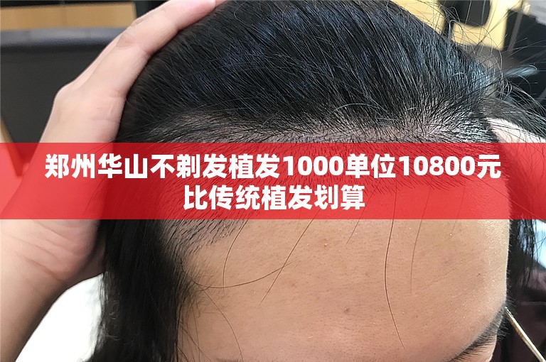 郑州华山不剃发植发1000单位10800元比传统植发划算