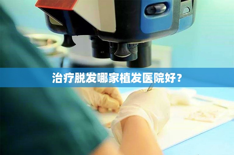 治疗脱发哪家植发医院好？