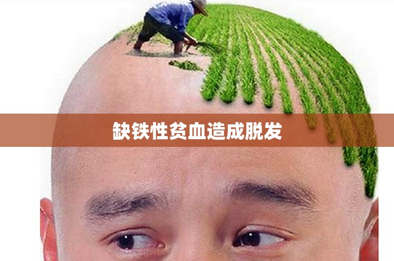 缺铁性贫血造成脱发