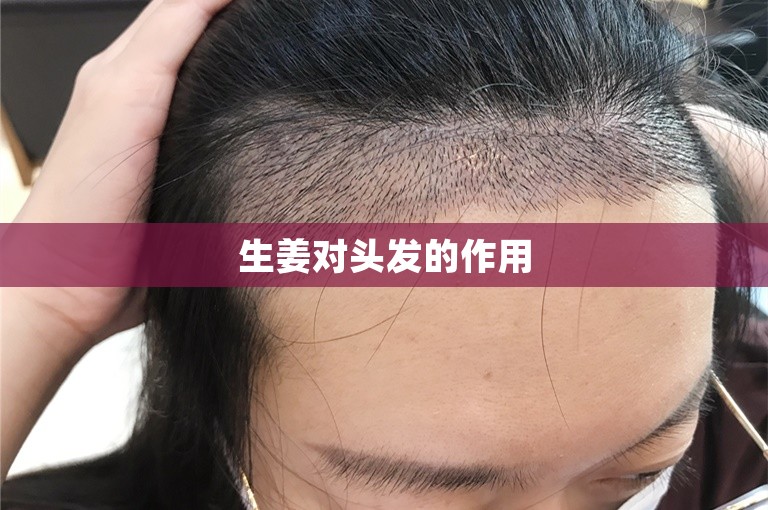 生姜对头发的作用