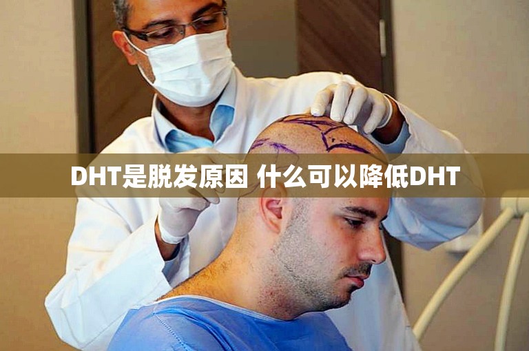 DHT是脱发原因 什么可以降低DHT