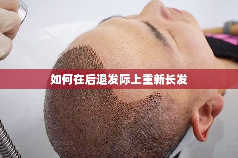 如何在后退发际上重新长发