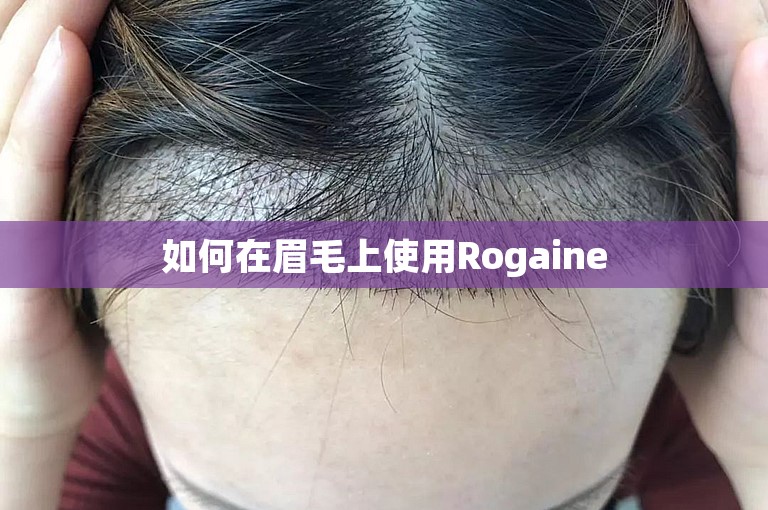 如何在眉毛上使用Rogaine