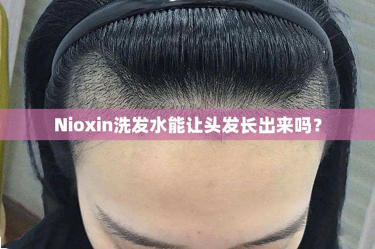 Nioxin洗发水能让头发长出来吗？