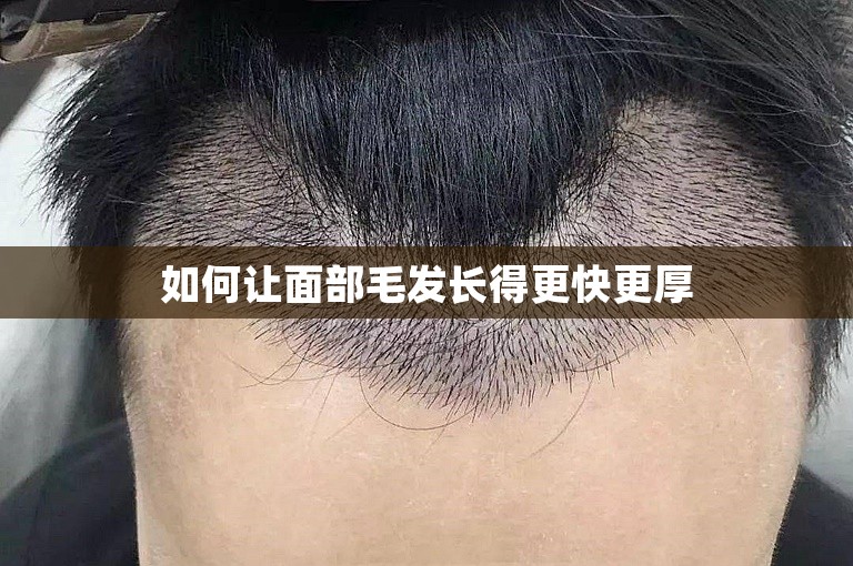 如何让面部毛发长得更快更厚