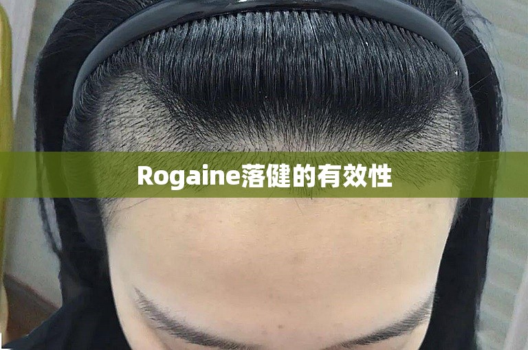 Rogaine落健的有效性