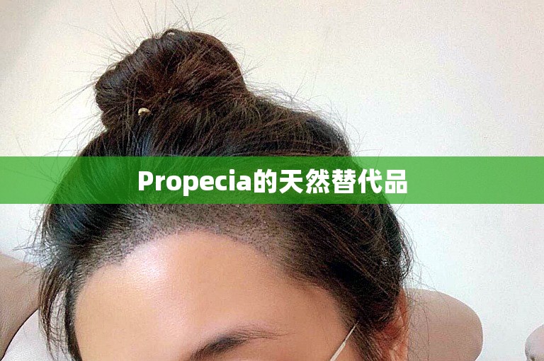 Propecia的天然替代品