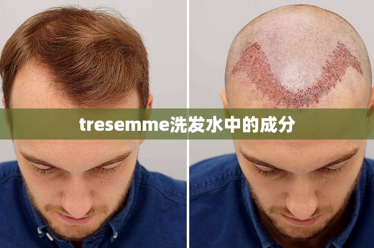 tresemme洗发水中的成分