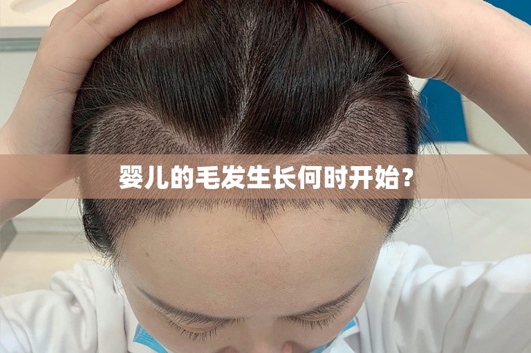 婴儿的毛发生长何时开始？