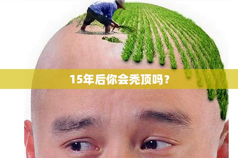 15年后你会秃顶吗？