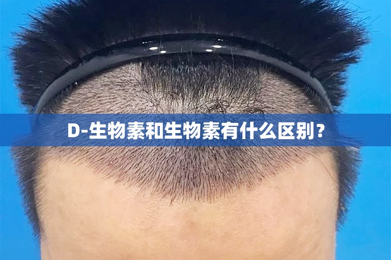 D-生物素和生物素有什么区别？