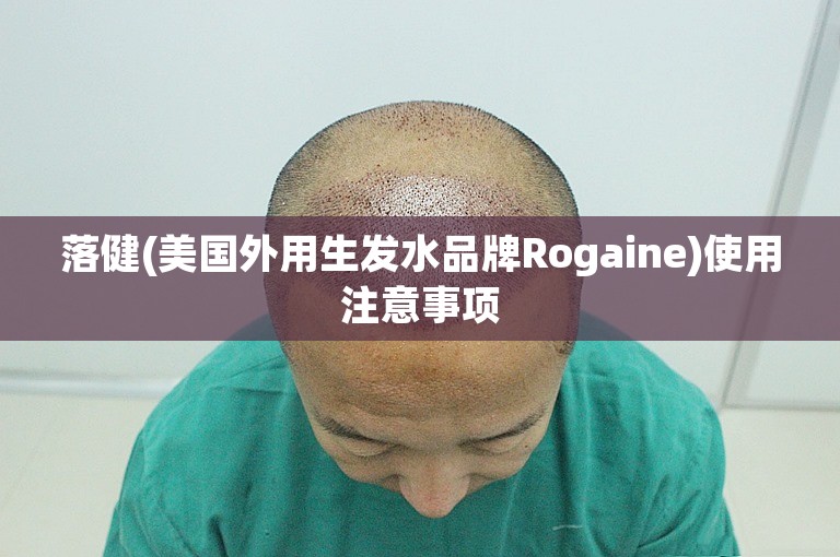 落健(美国外用生发水品牌Rogaine)使用注意事项