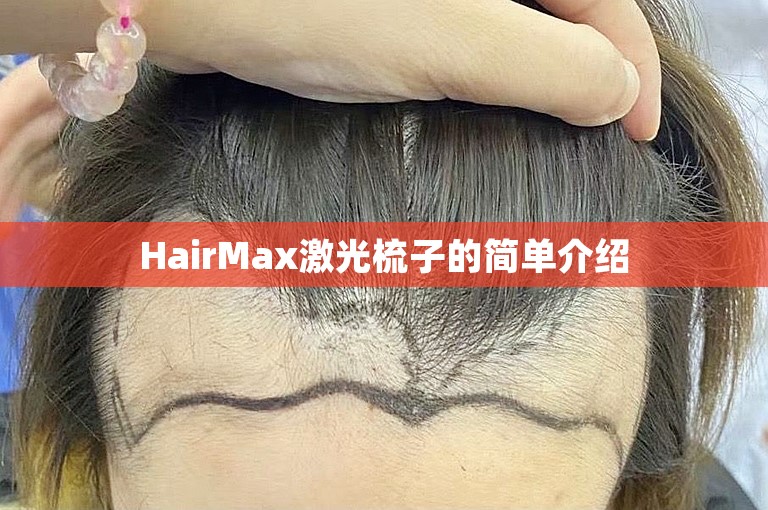 HairMax激光梳子的简单介绍