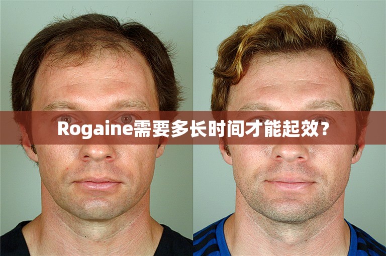 Rogaine需要多长时间才能起效？