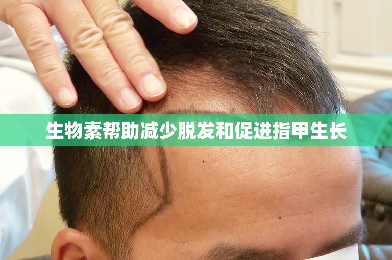 生物素帮助减少脱发和促进指甲生长