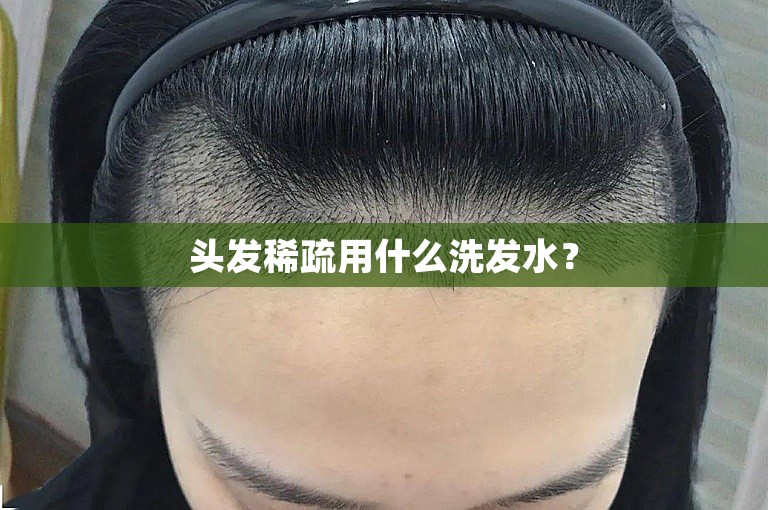 头发稀疏用什么洗发水？