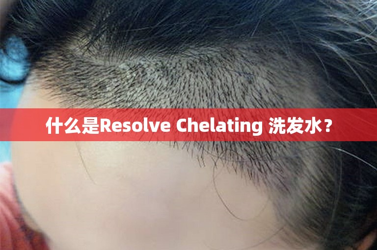 什么是Resolve Chelating 洗发水？