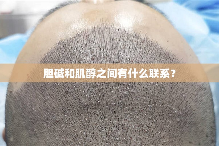 胆碱和肌醇之间有什么联系？