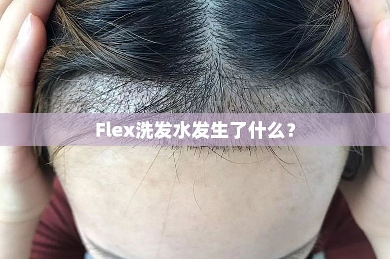 Flex洗发水发生了什么？